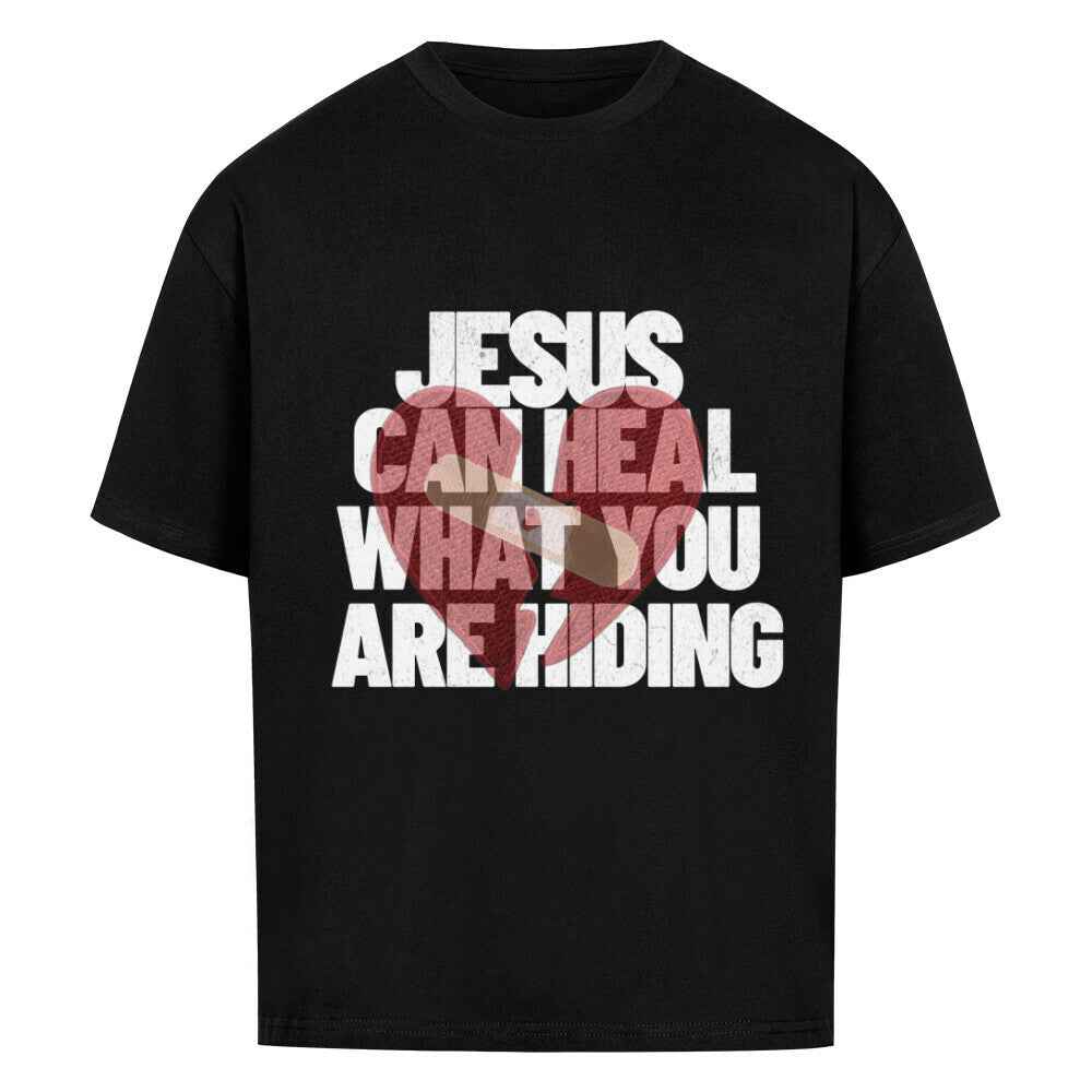 JESUS CAN HEAL YOU OVERSIZE SHIRT